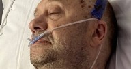 'I couldn't remember our holidays before diagnosis left me numb'