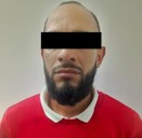 Detenido por morder a su expareja en el rostro