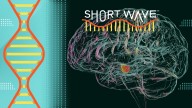 What stem cells could mean for the future of Parkinson's research : Short Wave : NPR