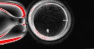 Researchers turn human skin cells into eggs -