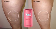 This Is The UK's First Anti-Cellulite Supplement – How Does It Work?