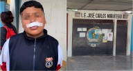 Pisco: menor es atacado por perro en el colegio José Carlos Mariátegui