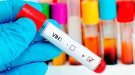 Censida advierte: 80 mil personas en México podrían vivir con VIH sin saberlo