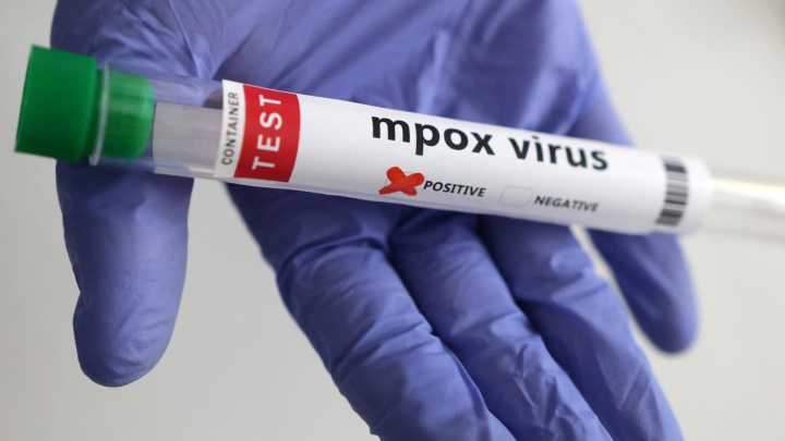 Mpox cases in California linked to global travel. Here's what to know