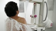 Major overhaul ordered for panel that sets Canada's cancer screening guidelines