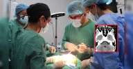 Médicos salvan la vida de un niño que llegó de Jaén a Lima porque tenía una piedra incrustada en el cráneo