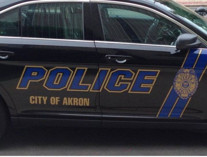 One shot in robbery near Akron vape store