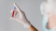 28.000 nuevos casos de cáncer hematológico en España, con mejor pronóstico en mujeres y jóvenes