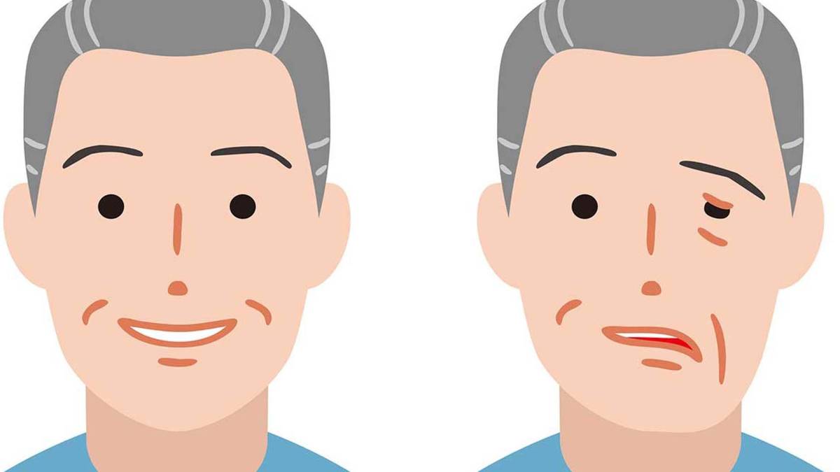 ¡Cuidado! 4 de cada 10 mexicanos viven con colesterol elevado, factor clave para un infarto cerebral