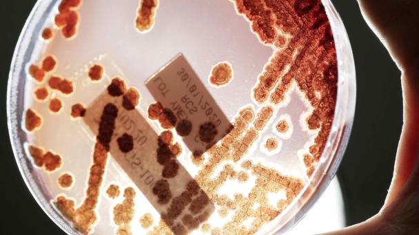 Aumentan en Estados Unidos las infecciones por bacterias resistentes a los antibióticos