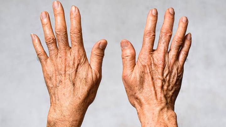 Dile adiós a la estética: el aceite esencial que hará que tus manos rejuvenezcan y se aclaren