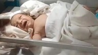 Abandoned days old baby found with rock in mouth and lips glued shut in India’s Rajasthan’s Bhilwara district