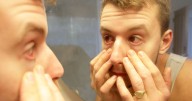 Optometrist urges people to look at corner of their eyes in morning for one colour