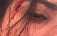 Brutal paliza en Zaragoza: una mujer pega a otra por unos mensajes de Whatsapp que envió a su novio