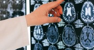 ¿Cómo prevenir el Alzheimer? 4 consejos de expertos que debes conocer