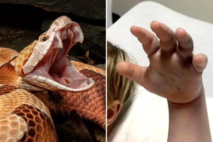 Boy, 4, bitten by snake at North Carolina day care as family learns staff never called 911: reports