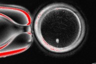 Researchers turn human skin cells into eggs