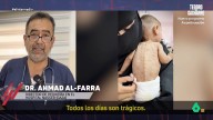 Un pediatra de Gaza pide "ayuda urgente" tras atender a 140 niños en un día: "Nunca habíamos visto nada así"