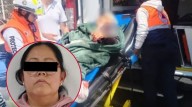 Le amputan brazo a una abuelita tras ataque de un perro Pitb...