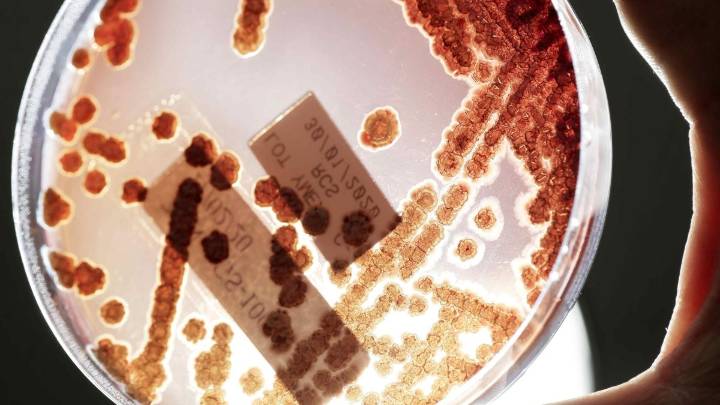 Aumentan en EEUU las infecciones por bacterias