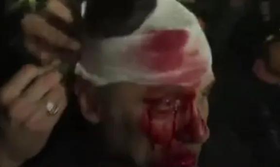 Grave ataque a la prensa: periodista de América TV golpeado en acto de Milei