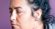 Mum and daughter scarred for life after dog rips into faces in horror attack