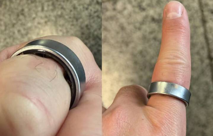 La batería de un anillo inteligente se infló por lo que no podía quitáselo