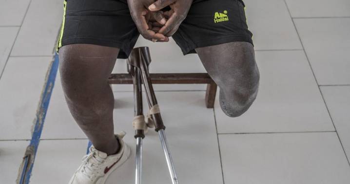 Photos of an orthopedic center in Congo that helps amputees regain mobility