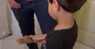 La historia de una ONG que entrega prótesis impresas en 3D a niños víctimas de bombardeos en Gaza