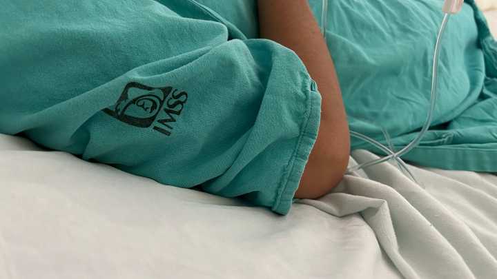 Hay 6 hospitalizados por explosión; policía es quien presenta más quemaduras: IMSS