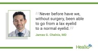 Noninvasive OptiLift addresses ‘root cause’ of dry eye