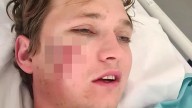Stag do bloke, 27, mauled by two ferocious HYENAS after being dragged out of tent where he was sleeping off booze