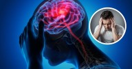 Día Internacional de Acción contra la  Migraña: Una condición neurológica que afecta a millones en el mundo