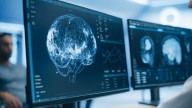 How you MOVE could reveal an early sign of Alzheimer’s disease