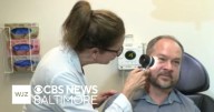 Maryland man shares his brush with melanoma and importance of routine checks