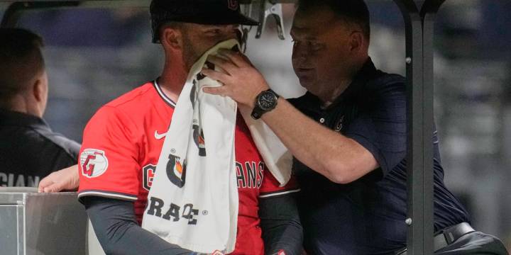 David Fry avoids surgery after sustaining facial, nasal fractures