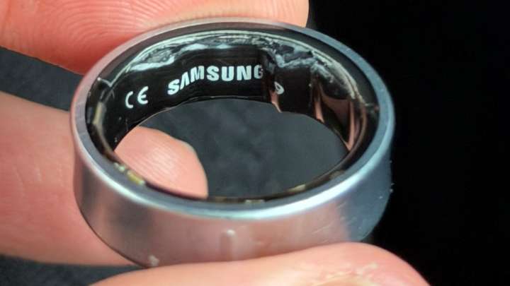 New fear unlocked: Samsung Galaxy Ring battery scare leaves user stranded and hospitalized