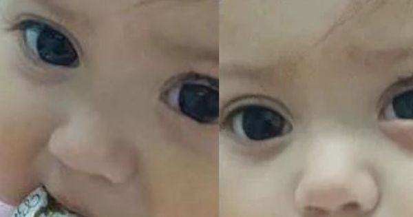 Olivia nació sin un ojo y comenzará su tratamiento gracias a colaboración de vecinos