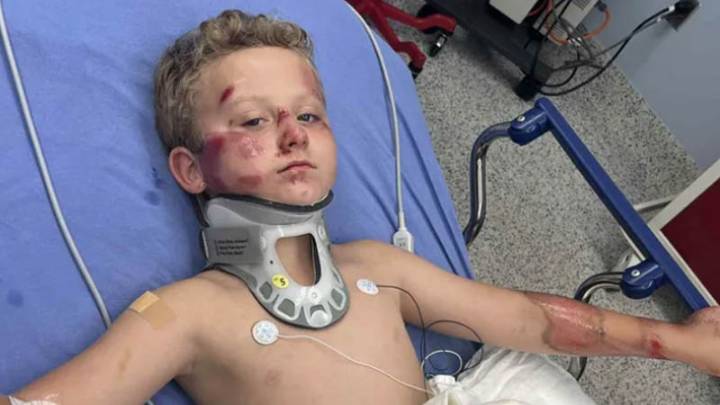Texas Boy Survives Horror Hit and Run as Family Begs for Justice