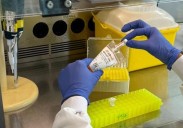 Nace el primer test en sangre que permite adelantarse al desarrollo del alzhéimer