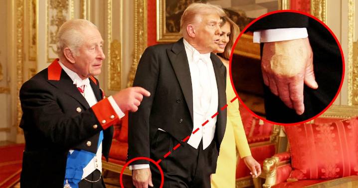 Royal Family Posts Very Honest Photo of Trump’s Hand Makeup