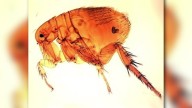 Symptoms of flea-borne typhus often confused with other illnesses