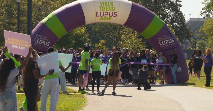 Hundreds gather for Walk to End Lupus Now in Nashville, raising awareness and funds