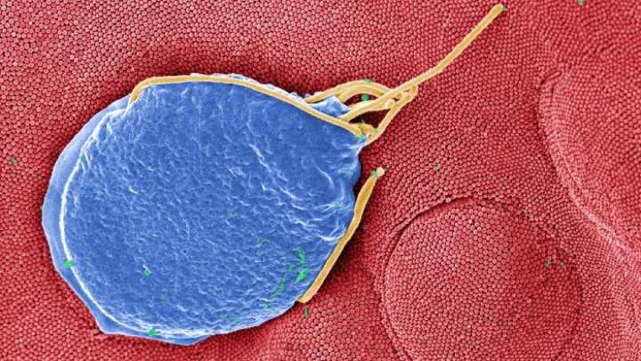 5 sickened by parasite in NH, natural spring water eyed as cause