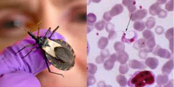 Científicos alertan que hay transmisión autóctona de la enfermedad de Chagas en los Estados Unidos