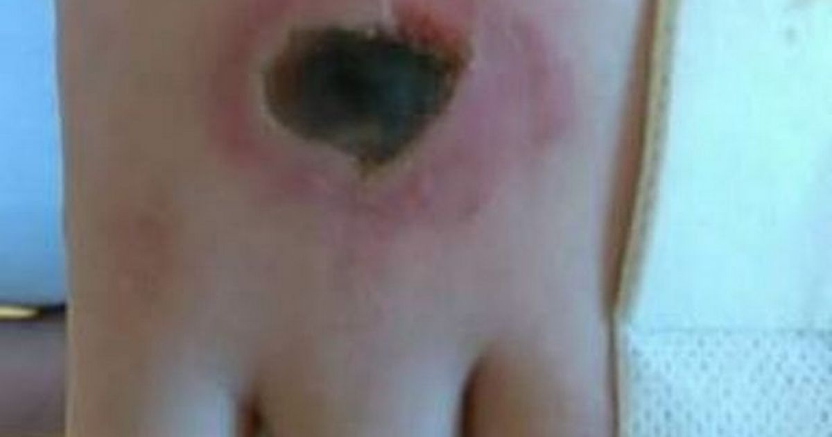 Police issue urgent warning over 'dangerous' 'salt and ice challenge' craze