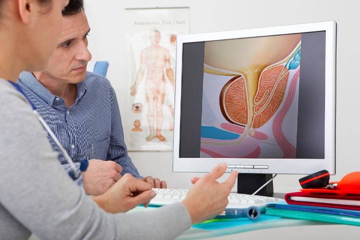 Advanced Prostate Cancer Cases Rising as Fewer Men Are Screened, New Report Says