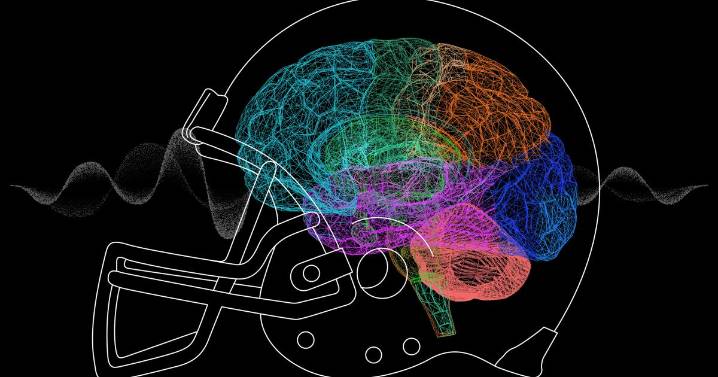 NFL and UFC athletes try 'game-changing' psychedelic to treat brain injury