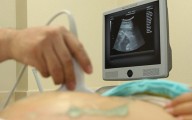 IMSS Estado de México Oriente fortalece atención a mujeres con embarazos de alto riesgo 