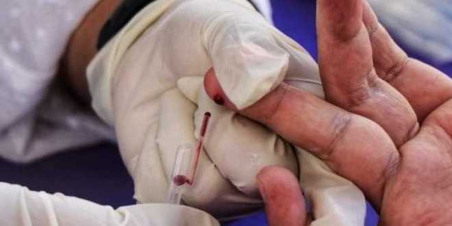 VIH y tuberculosis, doble reto en Tabasco